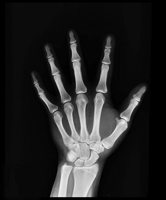 The Mighty Mineral: Magnesium and Its Crucial Role in Bone Health